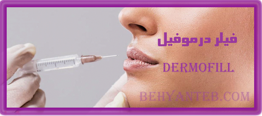 فیلر درموفیل