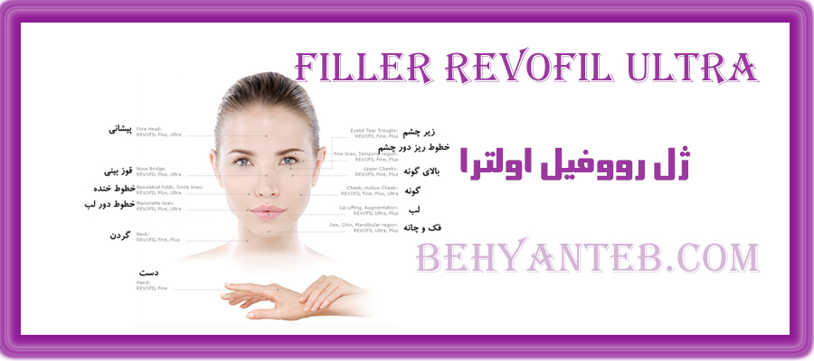 ژل رووفیل اولترا 