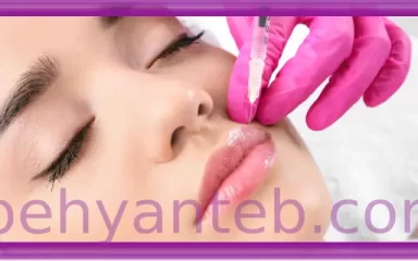مراقبت بعد از نگهداری ژل