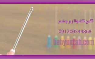 گیج کانولا زیر چشم